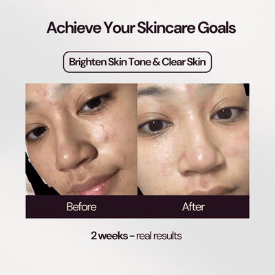 Bakuchiol 2% Skin Booster+