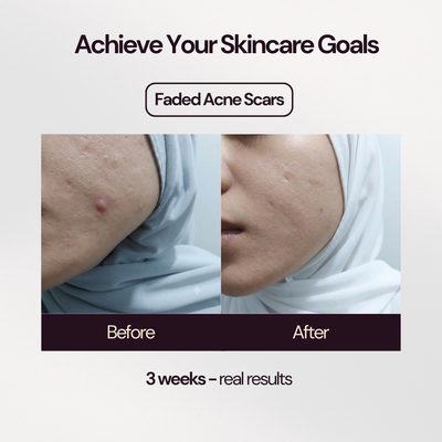 Bakuchiol 2% Skin Booster+
