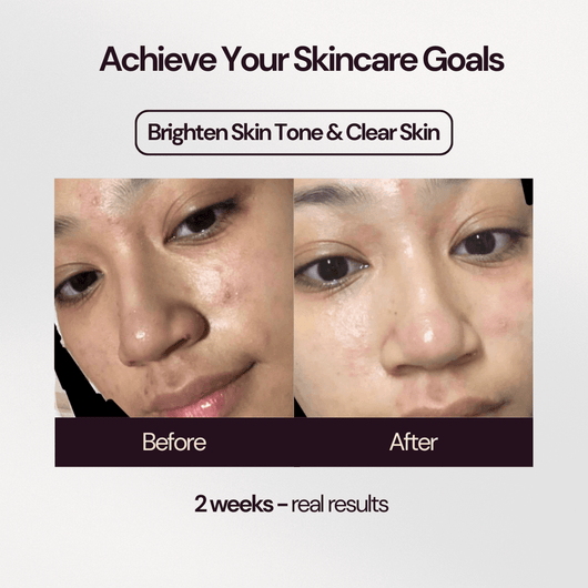 Bakuchiol 2% Skin Booster+